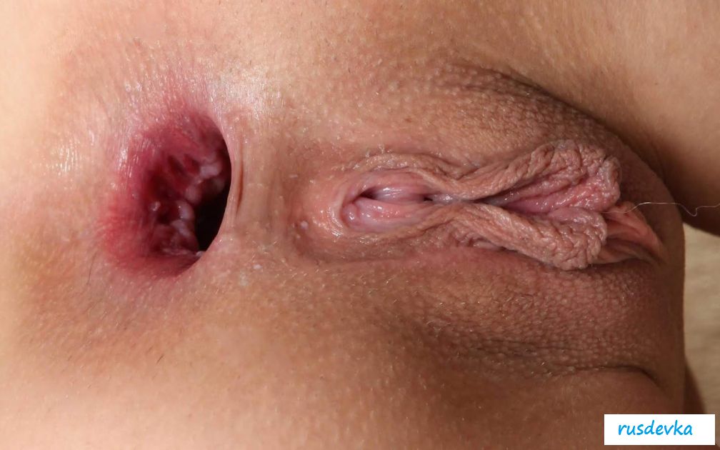 Раскрытое влагалище и анус