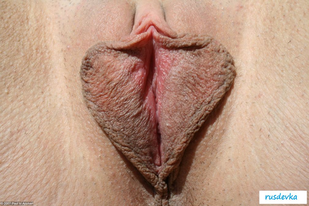 Маленькие половые губки